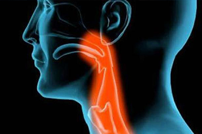 Рак горла: симптомы, диагностика, лечение, стадии и профилактика онкологии гортани