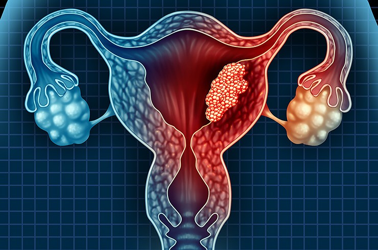 endometrium rák pembrolizumab