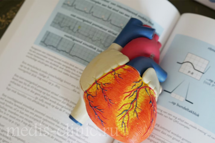 Каковы некоторые факторы риска сердечно-сосудистых заболеваний?