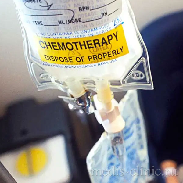 Побочные эффекты химиотерапии!