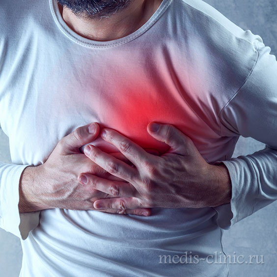 Что нужно знать про сердечный приступ или инфаркт миокарда!